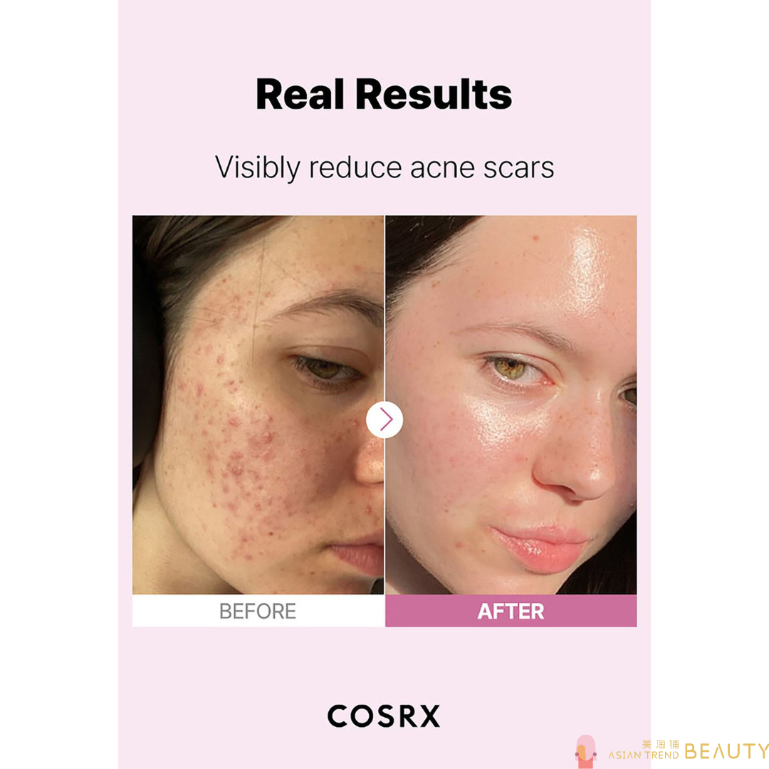 Cosrx The Niacinamide 15 Serum 20ml