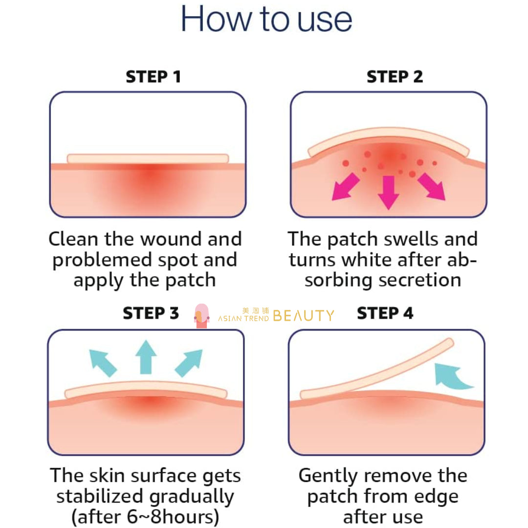 Olive Young Care Plus Scar Cover Spot Patch 102 Count