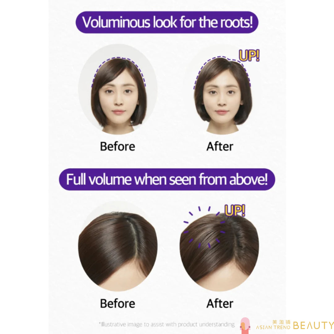 Ryo Hair Loss Expert Care Treatment 330ml