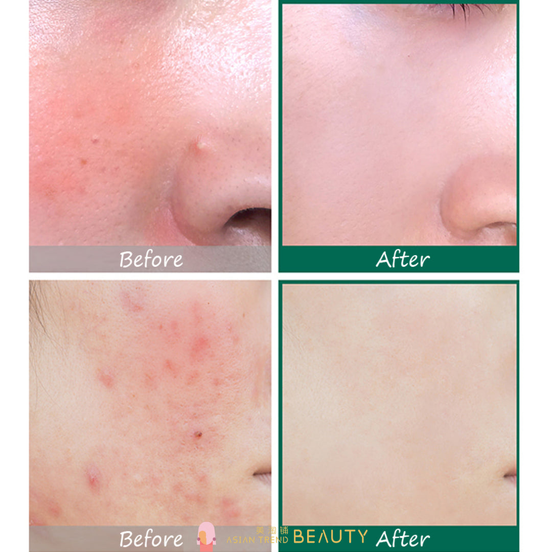 Some By Mi AHA, BHA, PHA 30 Days Miracle Serum 50ml
